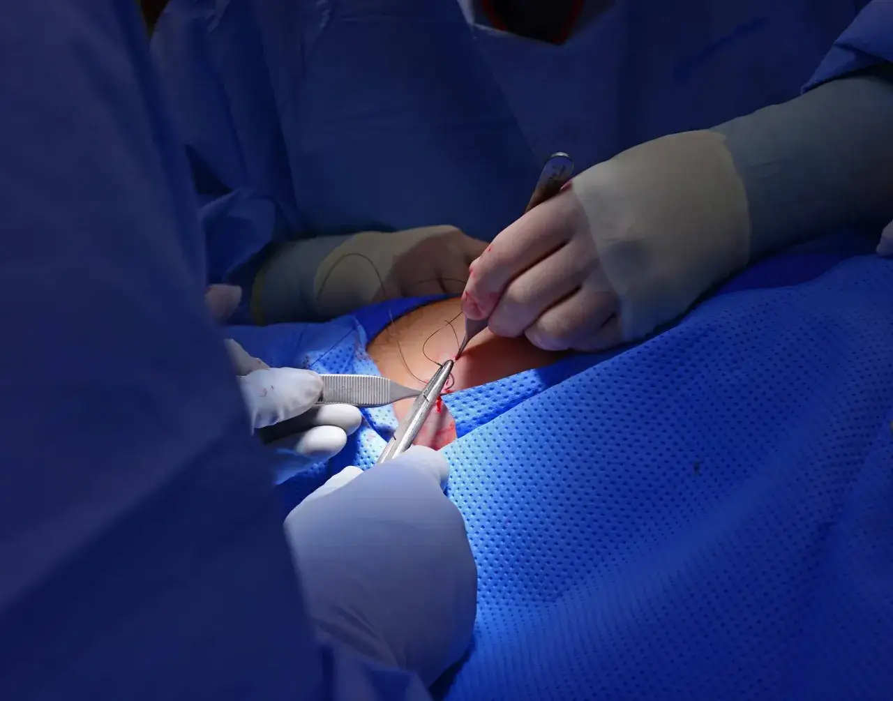 Zamykanie ran: Które techniki są najskuteczniejsze? Porównanie