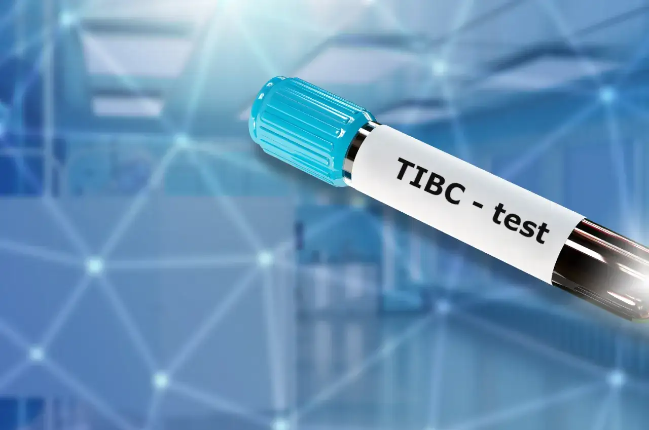 TIBC co to za badanie? Kluczowe informacje o badaniu żelaza