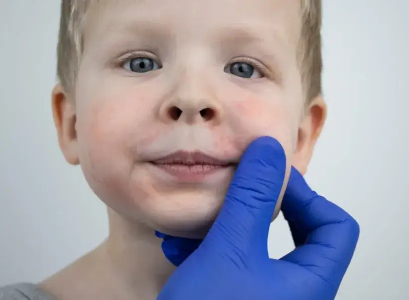 Podwyższony poziom limfocytów u dziecka - co powinno zaniepokoić rodziców?