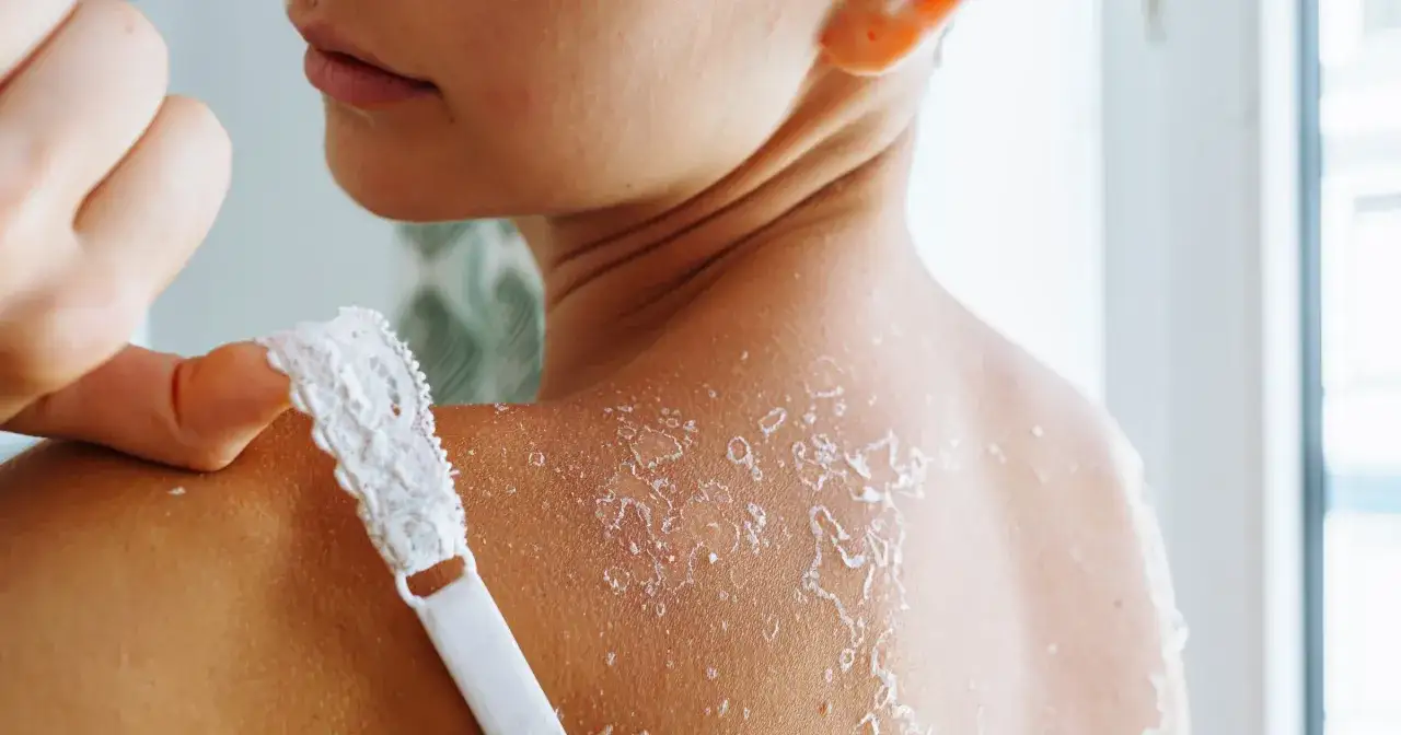 Wyciśnięty pryszcz? Szybka pomoc, by uniknąć blizn i zaczerwienień.