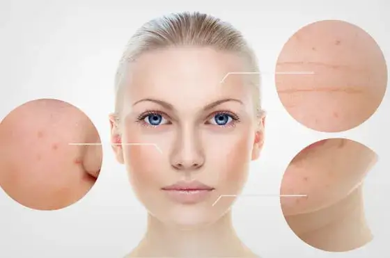 Co daje mikrodermabrazja? Odkryj jej niesamowite korzyści dla skóry