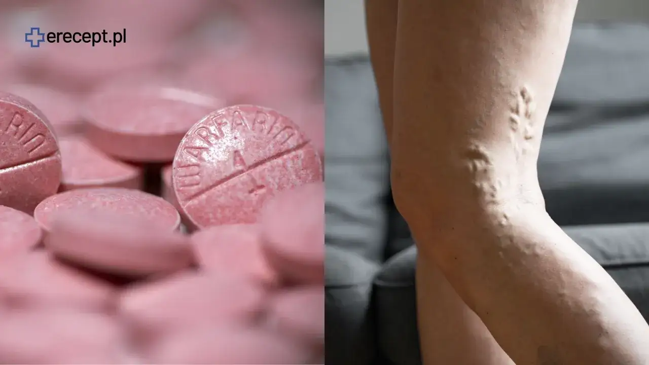 Leki rozrzedzające krew a witamina K: jedz bezpiecznie i stabilnie!