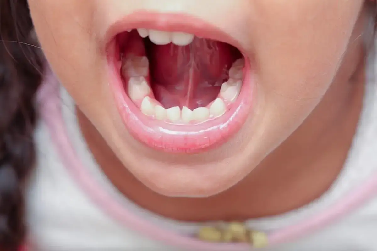 Ile zębów mlecznych ma dziecko? Odkryj ważne fakty o ich rozwoju