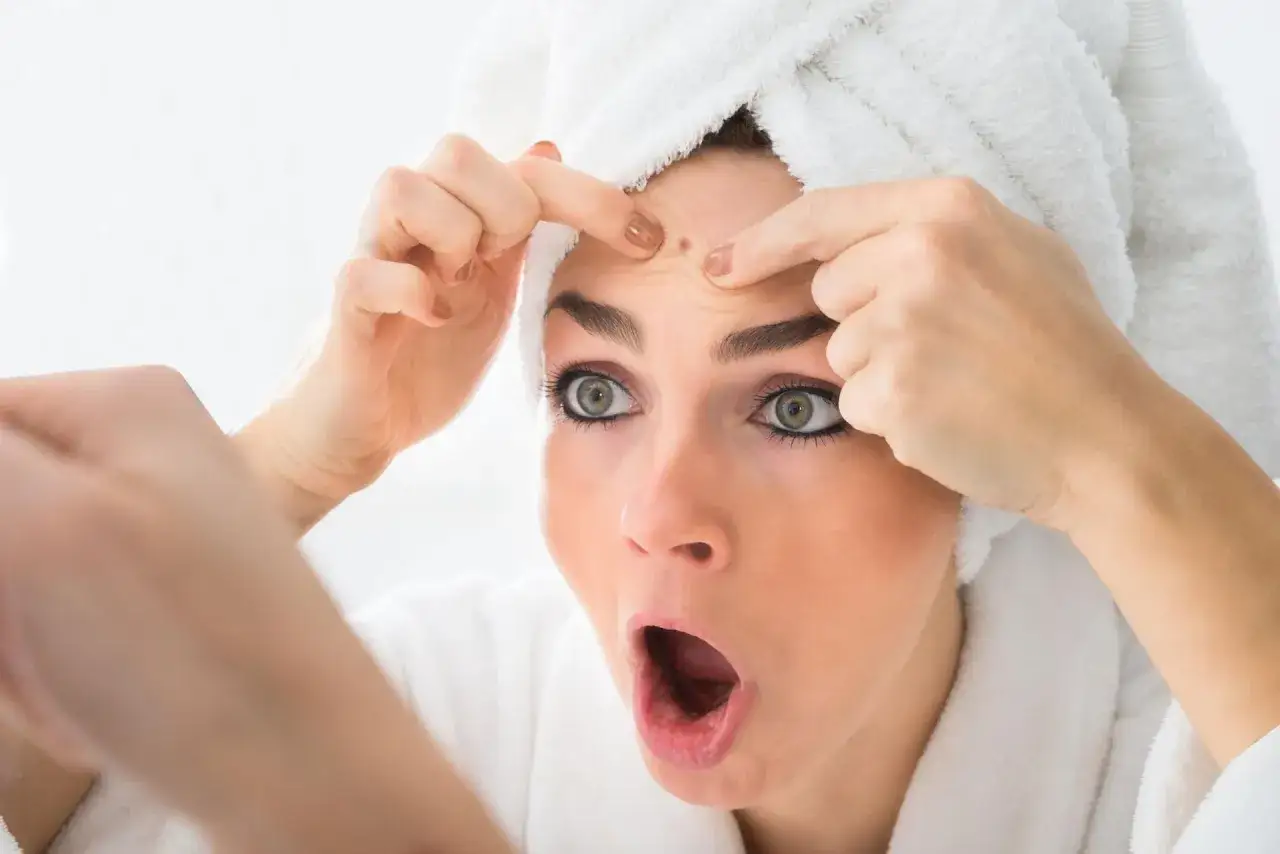 Pryszczy - jak sobie poradzić z nim domowymi sposobami?