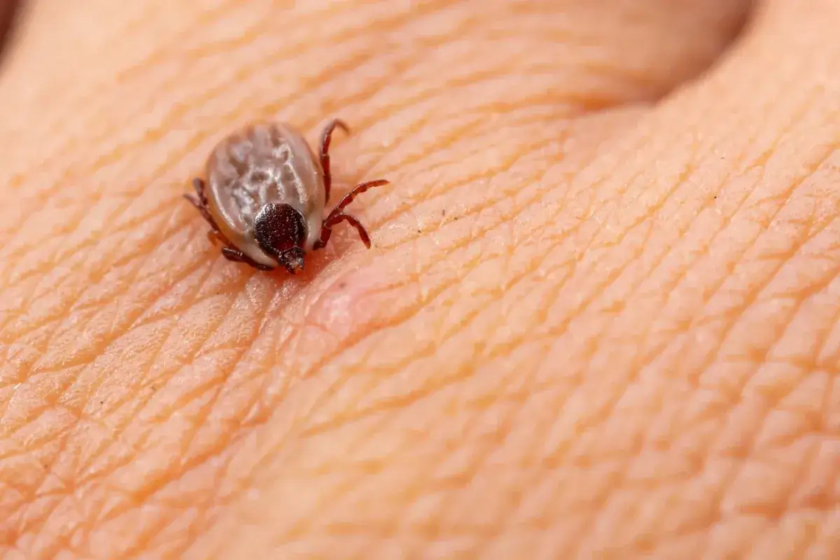 Kleszcz się urwał? Sprawdź, jak usunąć resztki i uniknąć boreliozy