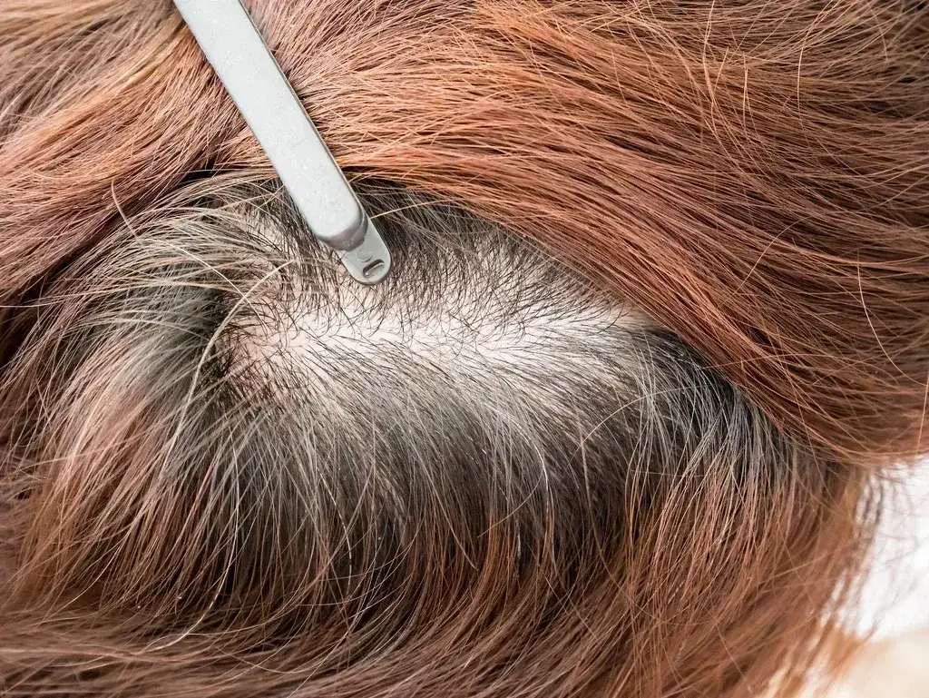 Jak zapobiec siwieniu włosów: skuteczne metody i zmiany w diecie