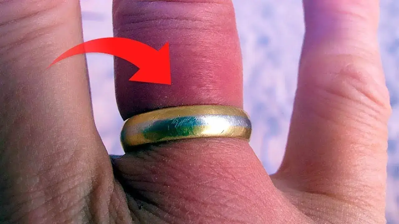 Jak zdjąć obrączkę bez bólu i skutecznie usunąć ją z palca