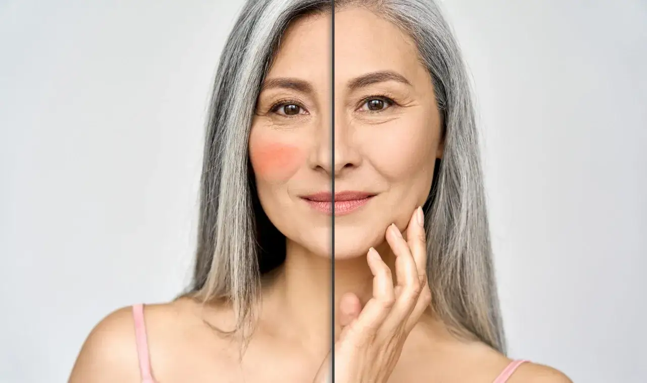 Rote Gesichtshaut? Welche Creme hilft wirklich & beruhigt nachhaltig