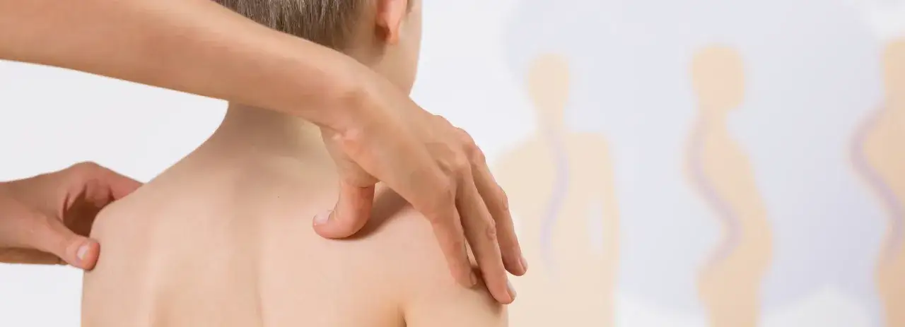 Ile trwa rehabilitacja skoliozy? Poznaj kluczowe czynniki wpływające na czas terapii