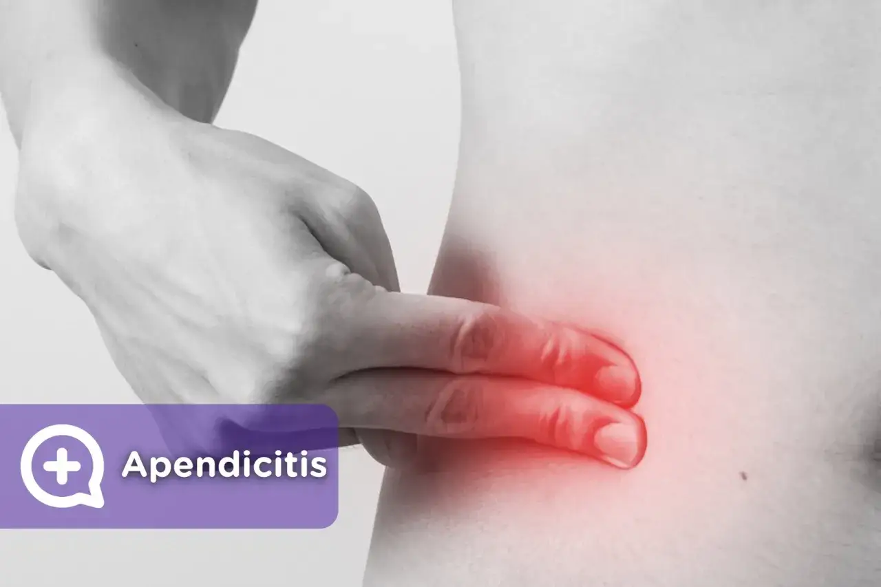 Apendicitis: ¿Dolor común o urgencia? Identifica los síntomas clave.