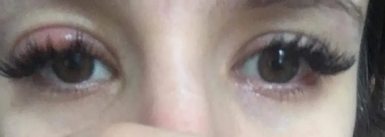 Uczulenie na tusz do rzęs objawy – jak je rozpoznać i unikać?