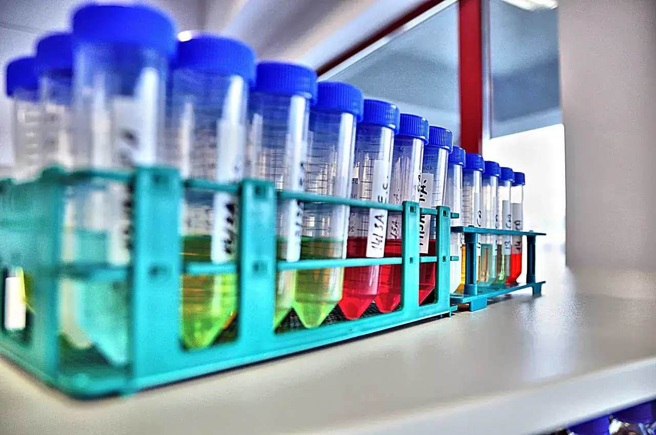 Laboratorium mikrobiologiczne – co naprawdę robi i jak pomaga zdrowiu