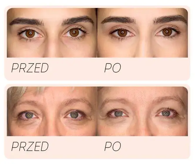 Krem rozświetlający pod oczy: Jaki wybrać? Skład i efekty