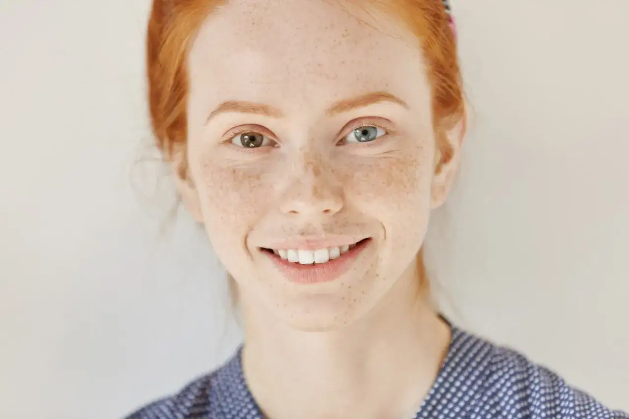 Ruda dziewczyna z piegami i różnymi kolorami oczu – przykład heterochromii.