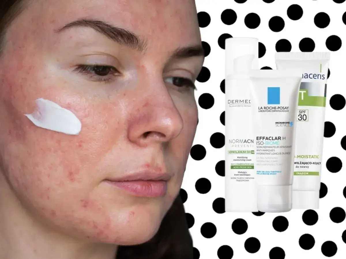 Kremy do cery suchej z wypryskami, które nie podrażniają skóry