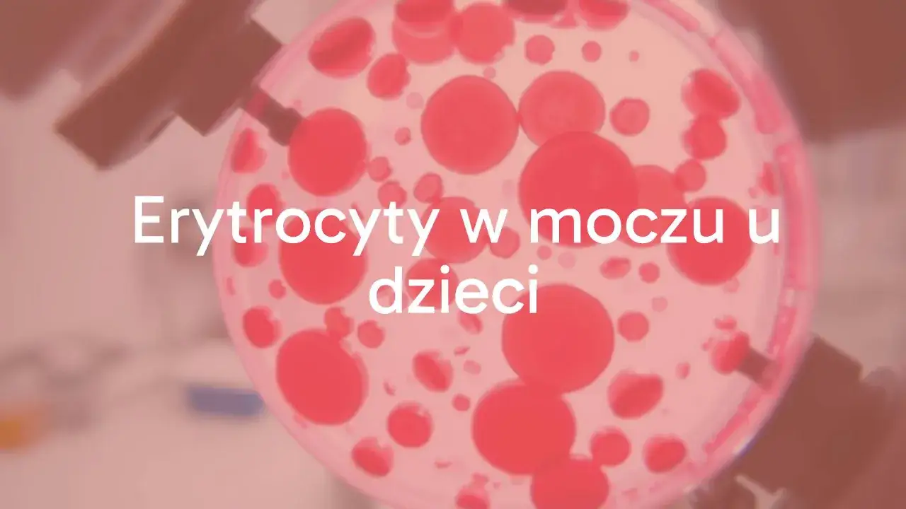 Badanie moczu: ogólne czy posiew? Zrozum różnice i diagnozę