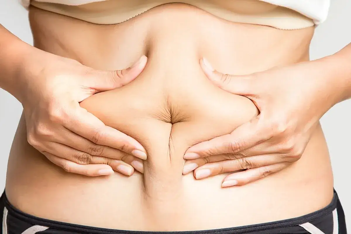 Liposukcja brzucha: Koszt, czynniki i jak uniknąć niespodzianek