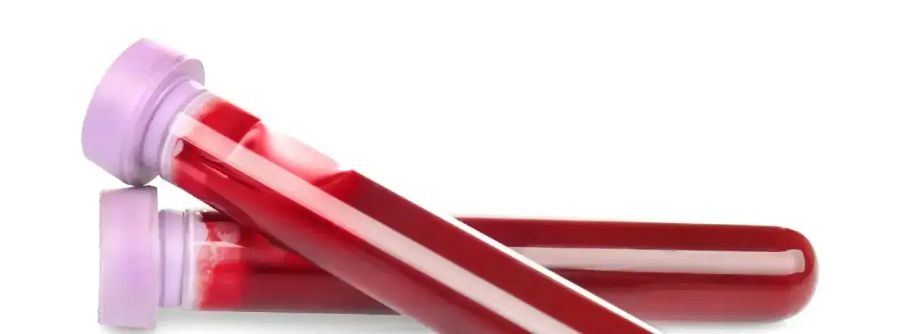 Ile kosztuje badanie grupy krwi w Polsce? Ceny, które warto znać