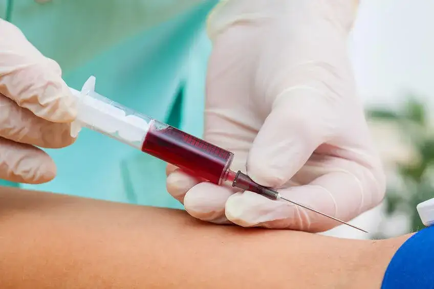 D-dimery co to za badanie? Normy, interpretacja i kiedy je wykonać