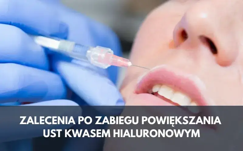 Czego nie wolno po powiększaniu ust? Kluczowe zakazy i ich znaczenie