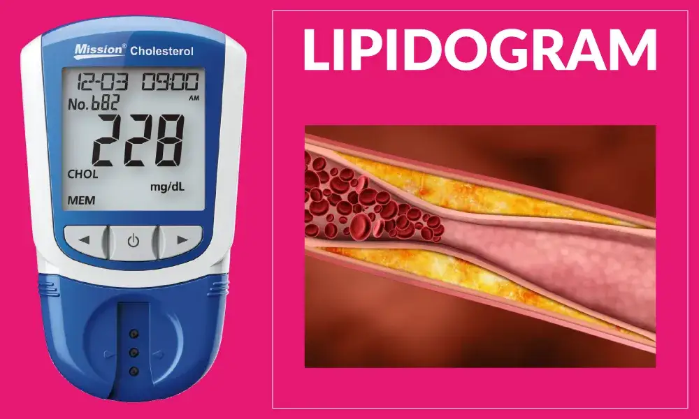 Badania na cholesterol czy na czczo? Kluczowe informacje, które musisz znać
