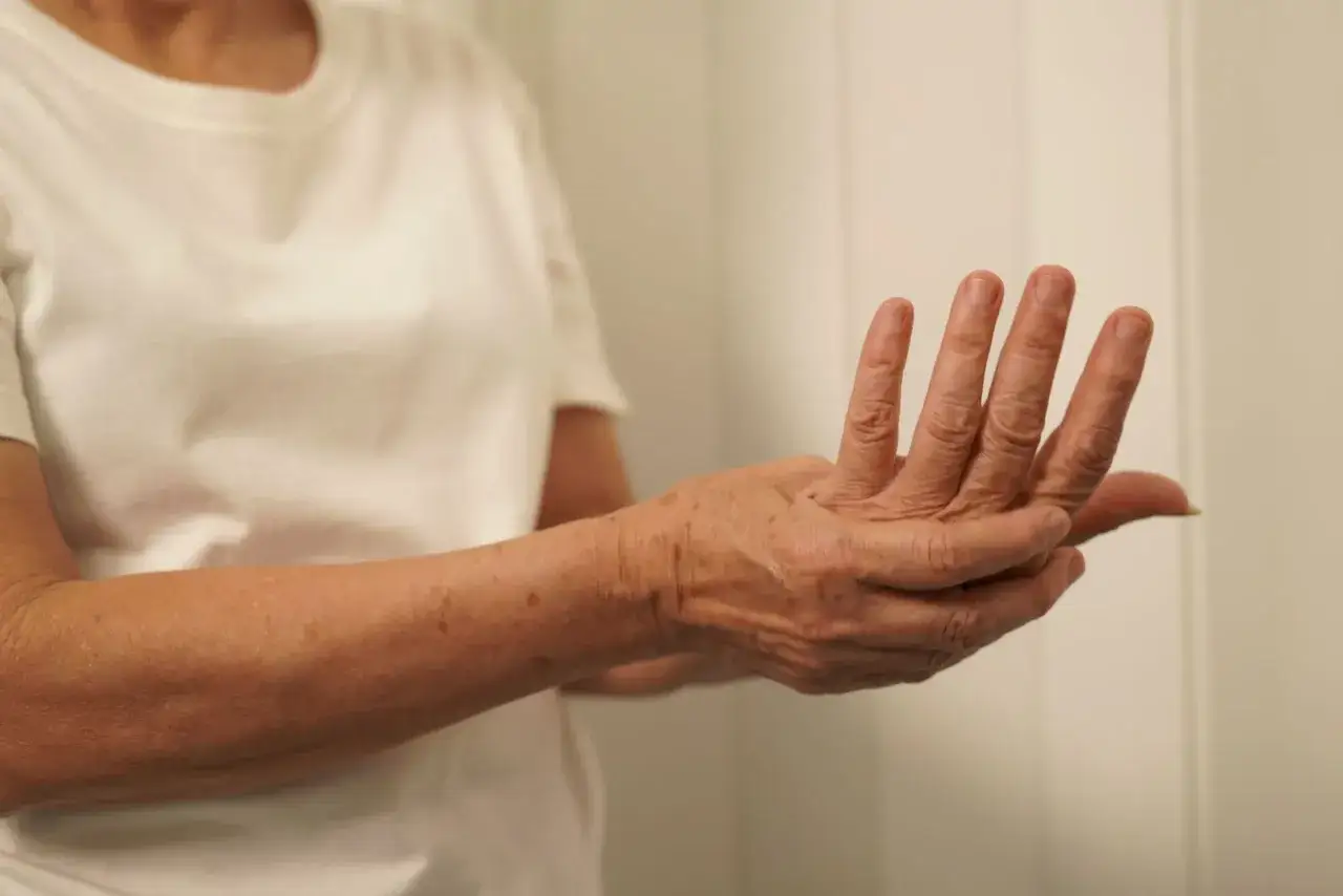 Leczenie mrowienia i drętwienia: Klucz do ulgi w parestezjach