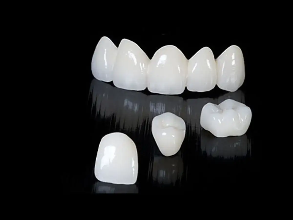 Korona zębowa: od 2h do 3 tyg. Poznaj realny czas leczenia