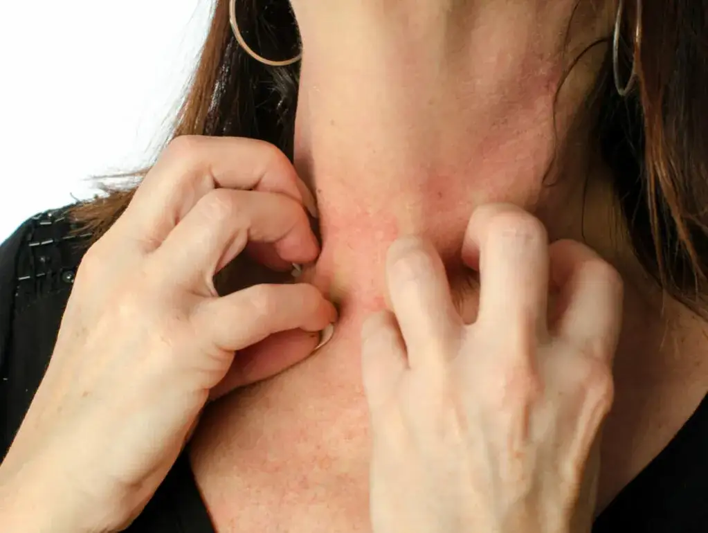 Allergie Parfum Symptome: So erkennen Sie die gefährlichen Anzeichen