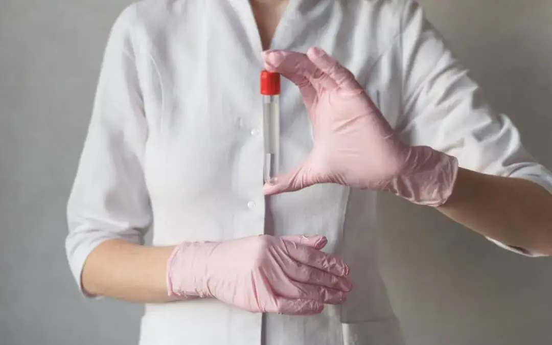 Urolog: jakie badania krwi? Poznaj kluczowe testy i ich sens.