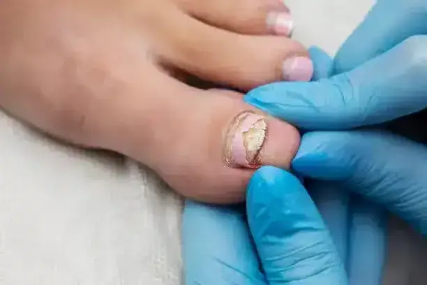 Jak szybko rosną paznokcie u nóg? Fakty, przyczyny i porady