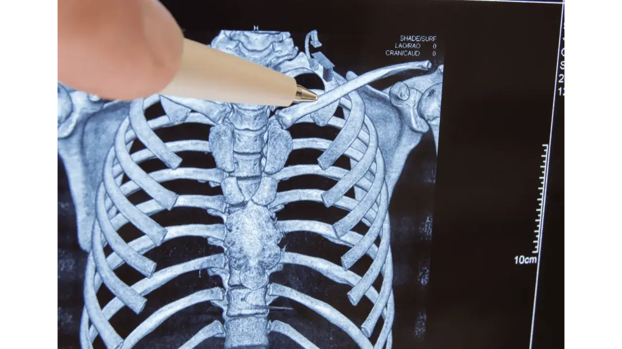 PZU: Odszkodowanie za samobójstwo? Poznaj zasady karencji