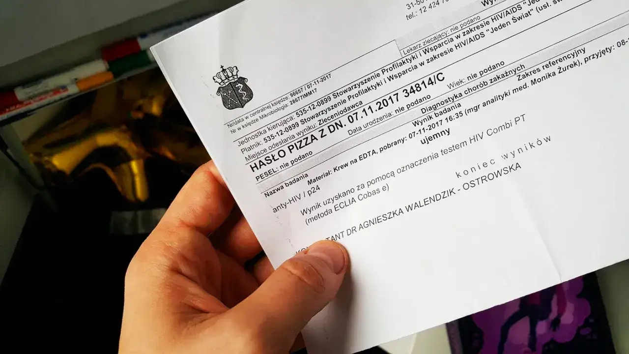 Jak wygląda badanie na HIV? Co musisz wiedzieć przed testem