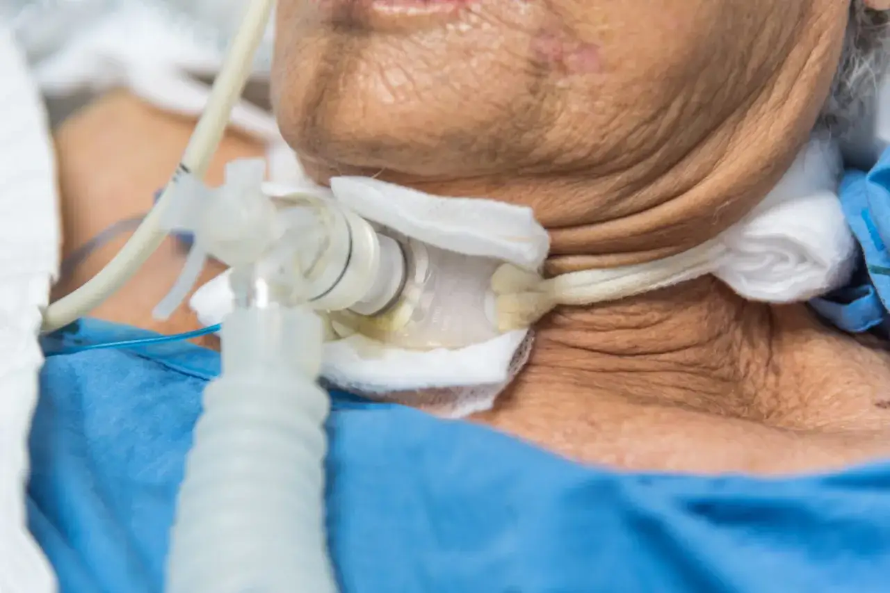 Zbliżenie na rurkę tracheostomijną u pacjenta w niebieskiej koszuli.