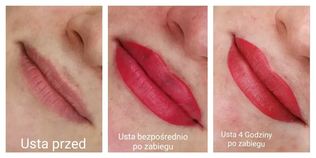 Makijaż permanentny ust: Gojenie dzień po dniu. Co Cię czeka?