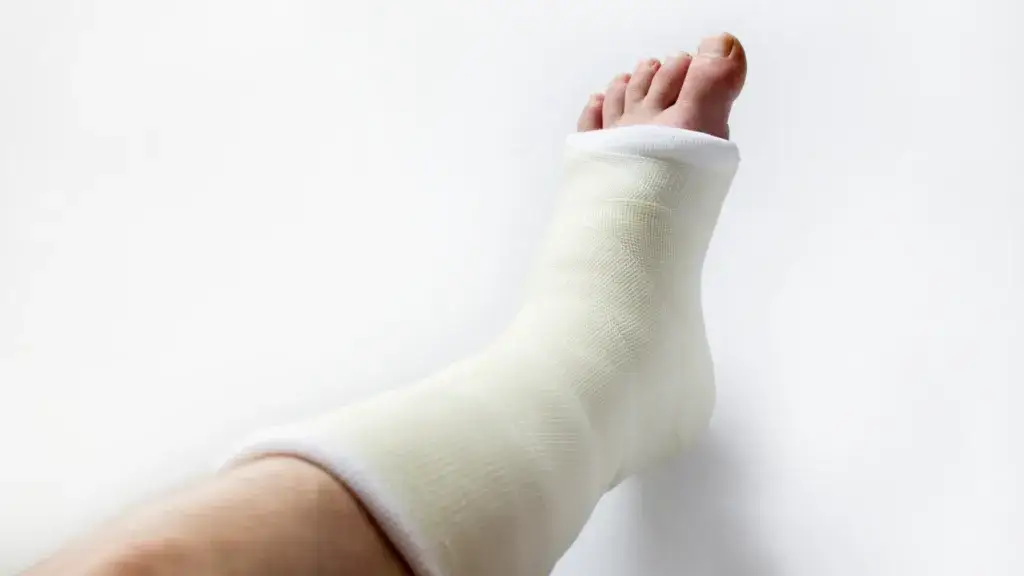 Kiedy zacząć rehabilitację po złamaniu, aby uniknąć powikłań?