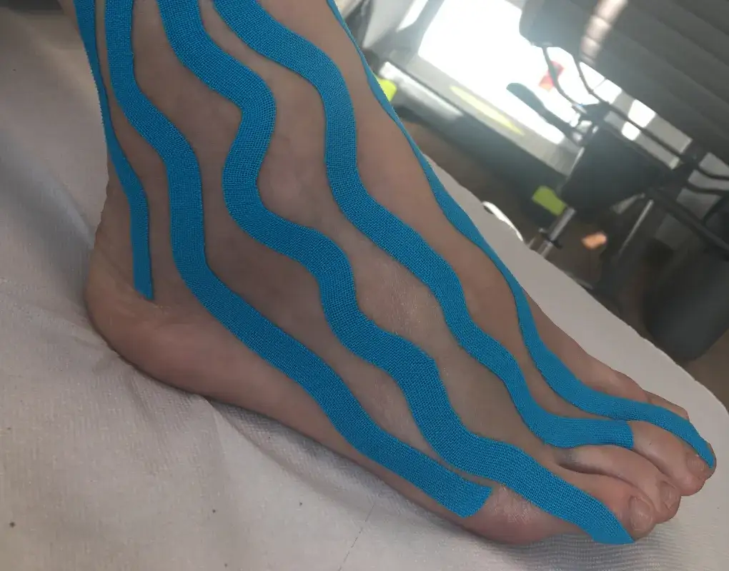 Co to jest elewacja kończyny dolnej i jak może przyspieszyć rehabilitację