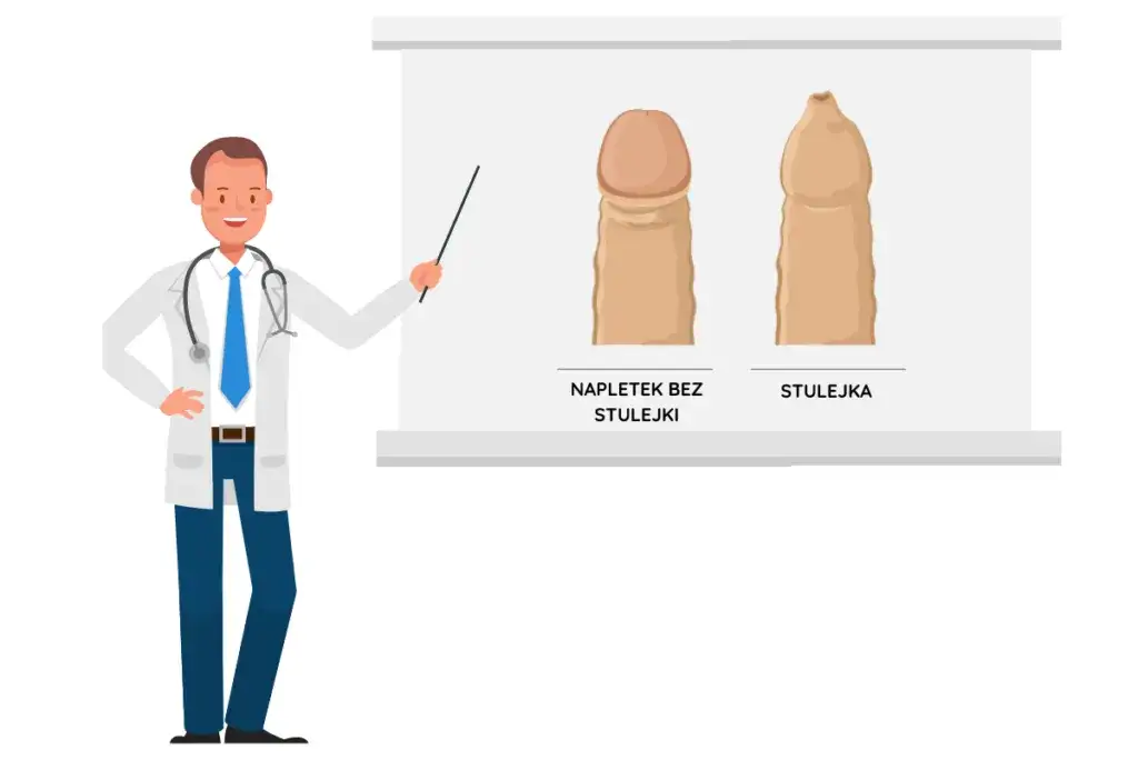 Stulejka: Urolog czy chirurg - Kto najlepiej leczy ten problem?