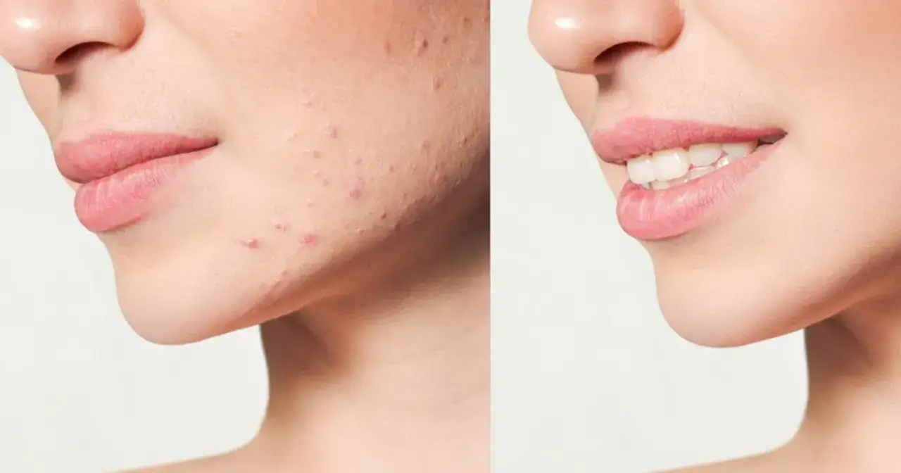 Twoja cera marzeń: Jak poprawić wygląd od diety po retinol?