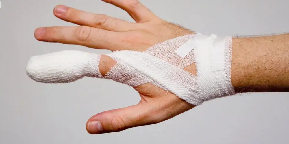 Wybity palec do jakiego lekarza? Sprawdź, jak uniknąć bólu i problemów
