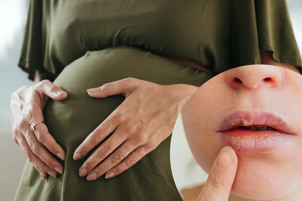Ciężarna kobieta z opryszczką na ustach. Szuka informacji: co na opryszczkę w ciąży.