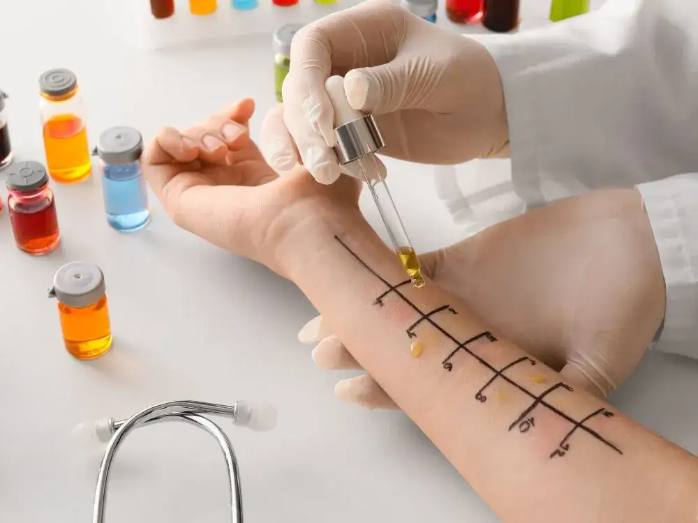 Gdzie zrobić testy alergiczne na leki i uniknąć niebezpieczeństw?