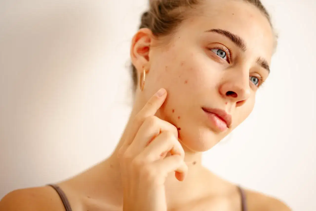 Gereizte Gesichtshaut? Mein Experten-Plan für Ruhe & Stärke