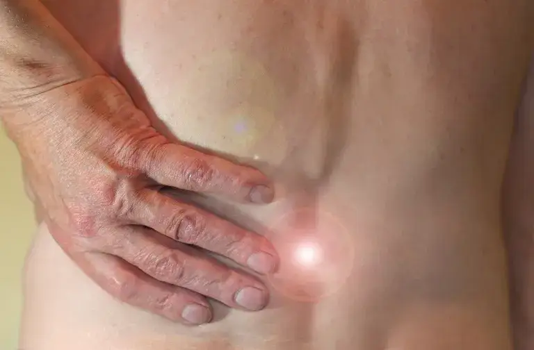 Guzki Schmorla do jakiego lekarza? Odpowiedzi, które musisz znać