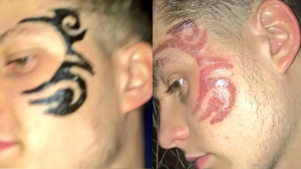 Henna do brwi jako tatuaż? Ryzykujesz zdrowie i blizny!
