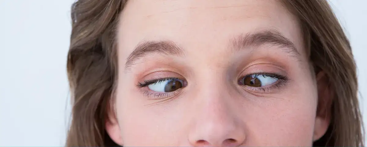 Czy zez jest dziedziczny? Poznaj genetyczne aspekty i ryzyko w rodzinie