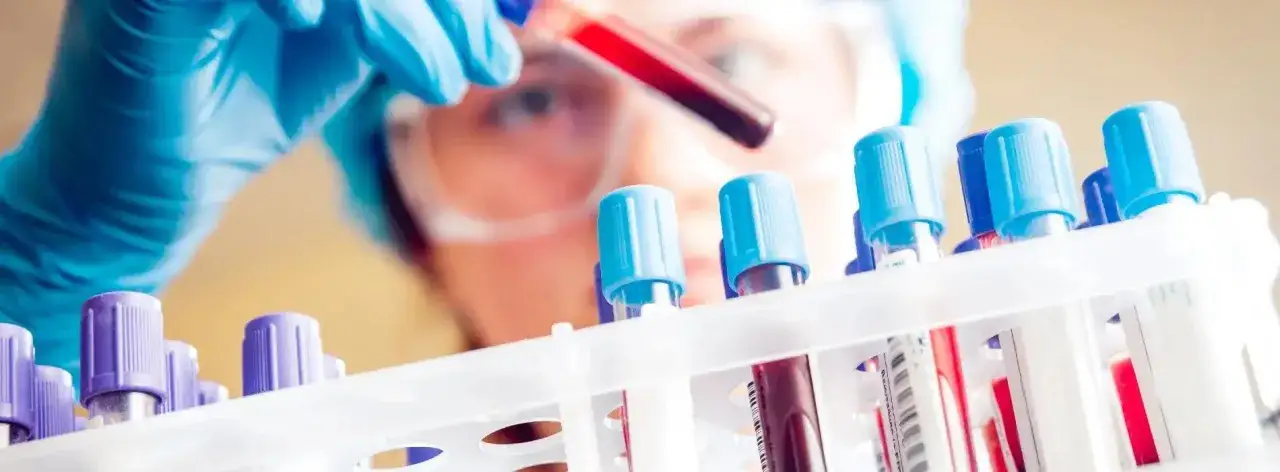 Jakie są badania z krwi? Poznaj ich znaczenie dla zdrowia