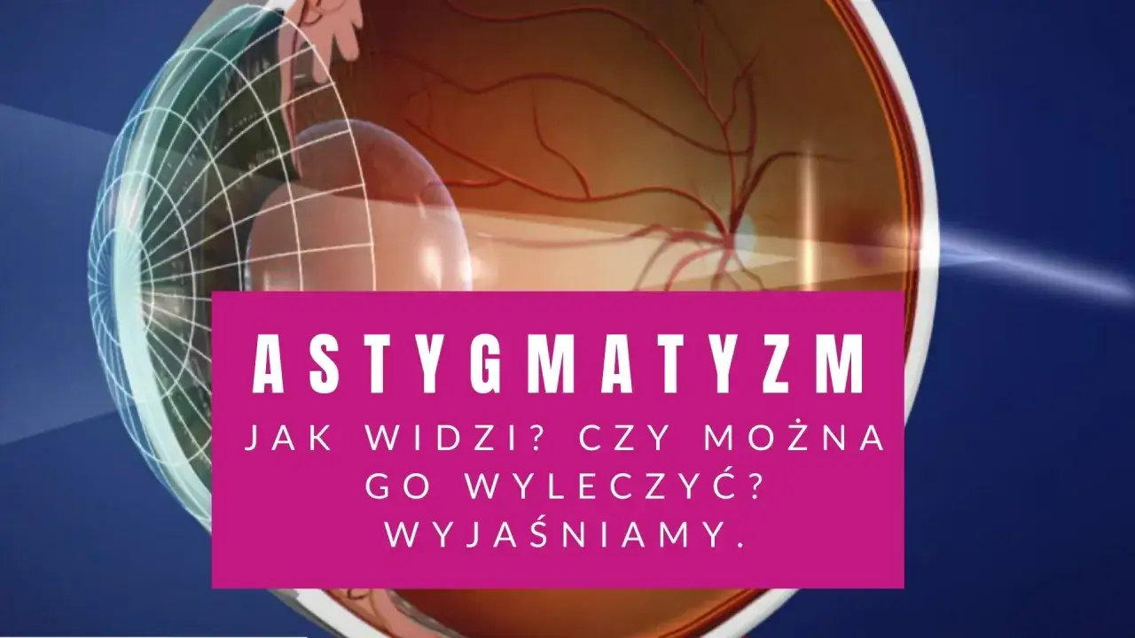 Astygmatyzm: jak widzi oko? Czy można go wyleczyć? Wyjaśniamy. Wizyta u okulisty lub optometrysty pomoże.