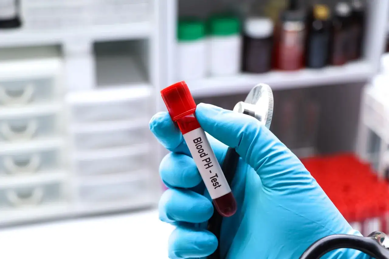 Ręka w niebieskiej rękawiczce trzyma probówkę z krwią do badania pH. Gazometria jest kluczowa w diagnostyce niewydolności nerek.
