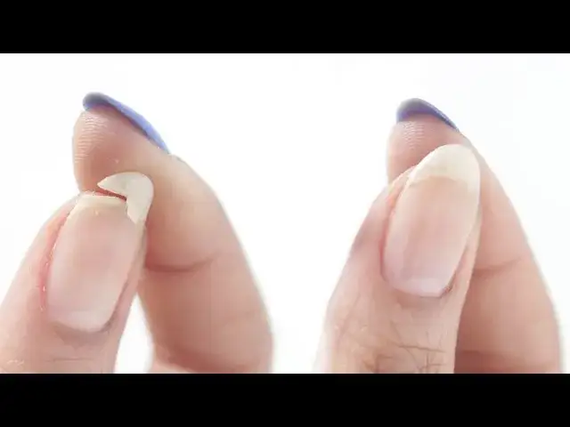 Czy pęknięty paznokieć się zrośnie? Odkryj prawdę o regeneracji