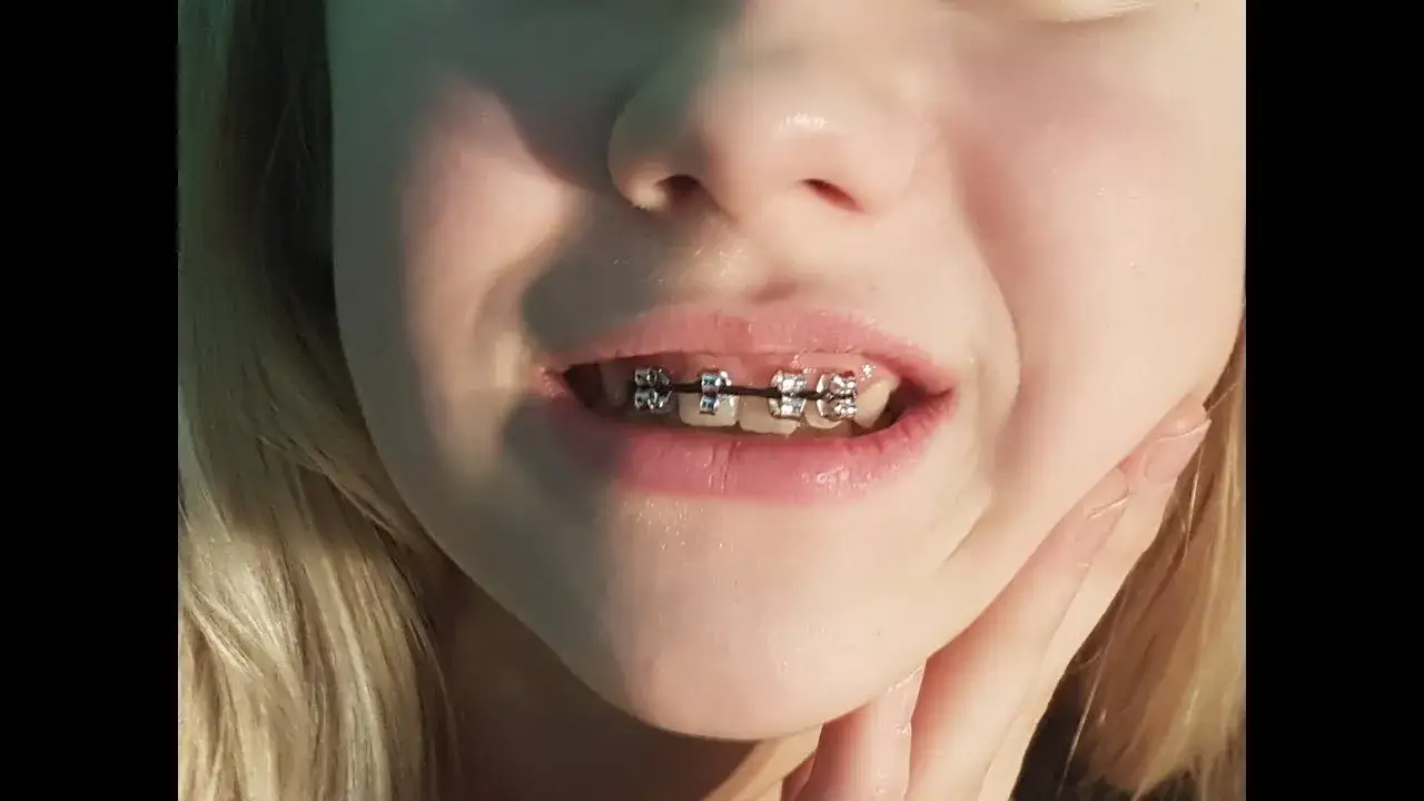 DIY sztuczny aparat na zęby: Jak zrobić bezpieczny rekwizyt?